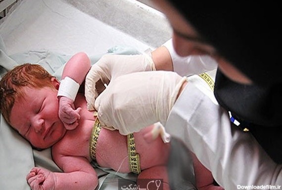 عکس نوزاد با وزن 2کیلو