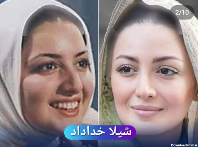 این 8 خانم بازیگر ایرانی صورتشان را از نو ساختند ! / چی بودند و چی ...