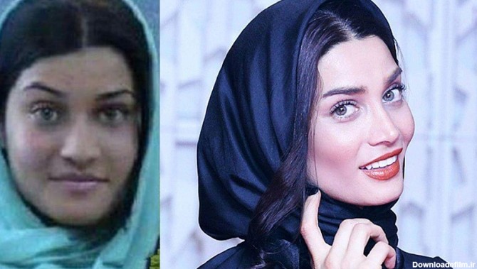 چهره بازیگران زن ایرانی قبل و بعد عمل زیبایی/ عکس
