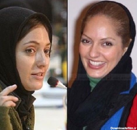 بازیگران زن ایرانی قبل و بعد از عمل جراحی / عکس - مهین فال