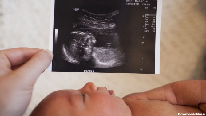 عکس جنین 4 ماهه دختر