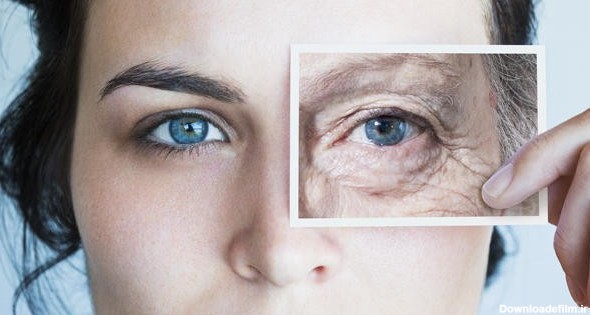 درمان چین و چروک دور و زیر چشم - کلینیک جوانسازی و زیباسازی پوست سپید