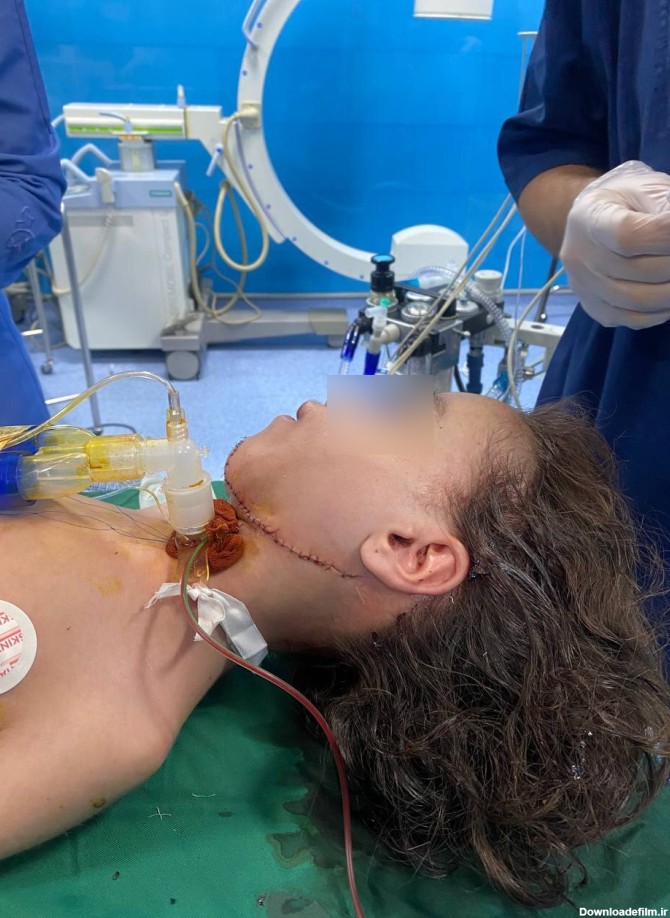 شاهکار پزشکان ایرانی: جراحی منحصر به فرد دختر 11 ساله در بیمارستان ...
