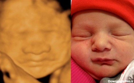 شباهت جالب کودکان قبل و بعد از تولد