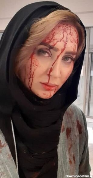 صورت خونی بازیگر زن جوان ایرانی / عکس