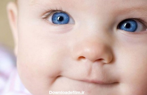 مهمترین علت انحراف چشم در نوزادان چیست؟