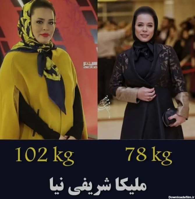 تغییرات حیرت آور بازیگران زن و مرد ایرانی + عکس ها را مقایسه کنید!