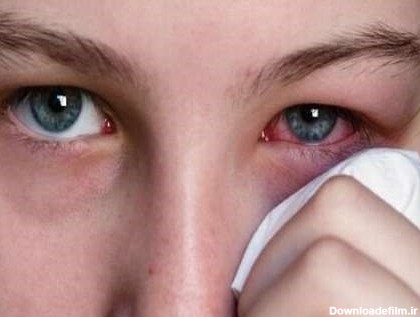 انواع آسیب چشمی یا ترومای چشمی و راه‌های درمان آن | پذیرش۲۴