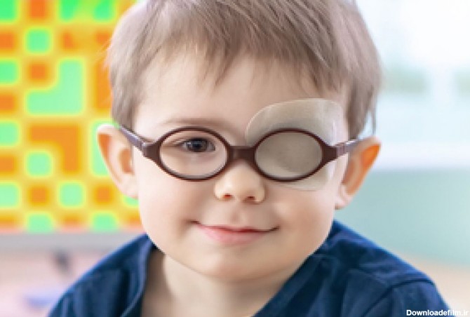 از کجا بفهمیم کودک تنبلی چشم دارد؟ | مرکز فوق تخصصی چشم ...