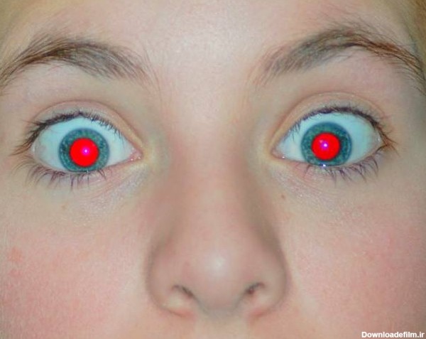 علت قرمزی چشم تو عکس و راه حل آن چیست؟