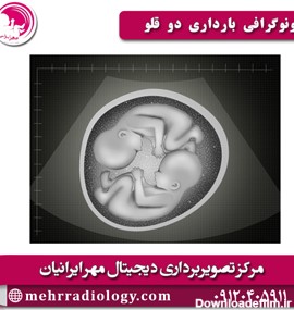 عکس سونوگرافی دوقلو پسر