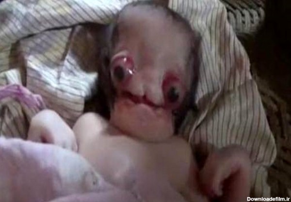 ترسناک‌ترین نوزاد جهان+ عکس