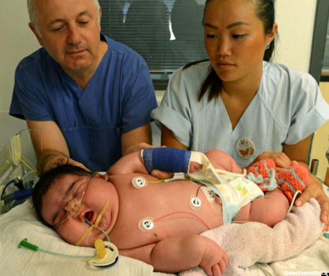 سنگین ترین نوزاد به دنیا آمد / عکس