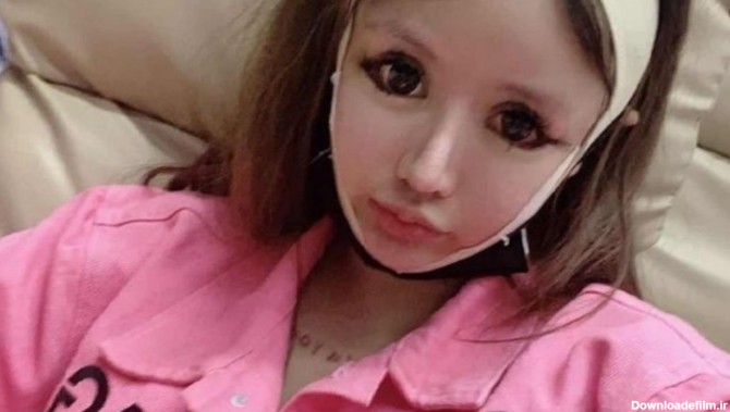 دختر نوجوان چینی ۱۰۰ عمل جراحی برای زیبایی انجام داد+ عکس | اقتصاد24