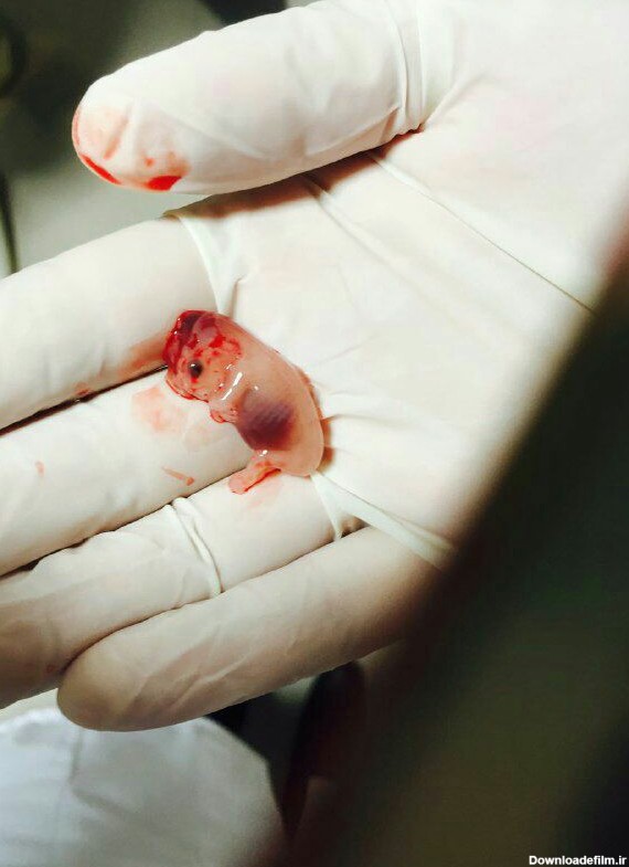 جنین یک و نیم ماهه - عکس ویسگون