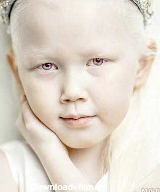 عکس سفید ترین دختر جهان - عکس نودی