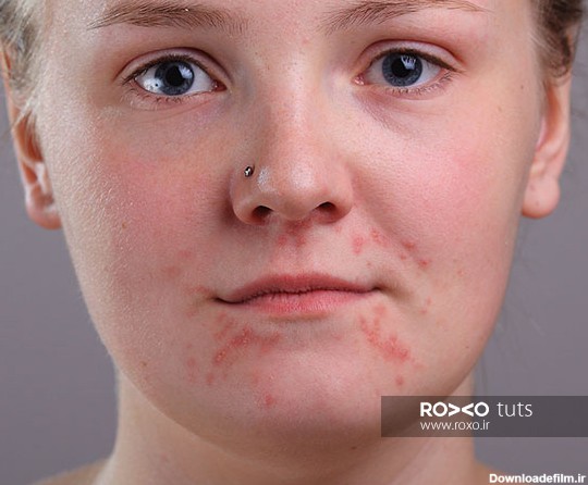 آموزش روتوش پوست و محو کردن لکه و جوش چهره در فتوشاپ - روکسو