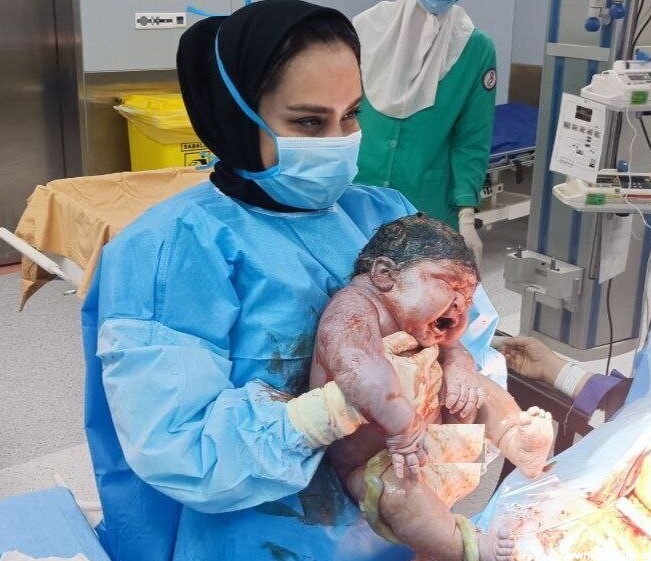 دلهره‌های شبانه تولد سنگین‌ترین نوزاد ایرانی + تصاویر | پزشک مهدی ...