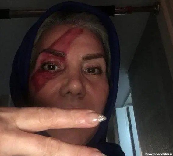 بلای وحشتناک مادر تتلو سر چهره اش بعد دستگیری پسرش+ تصویر