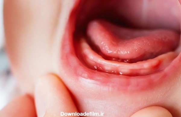 دندان درآوردن کودک؛ اولین مشکل جدی والدین.