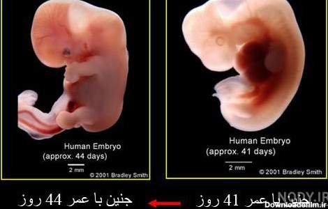 عکس جنین چهل روزه سقط شده