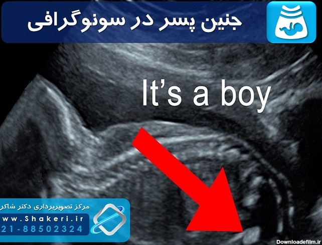 عکس جنین دختر و پسر در سونوگرافی و تفاوتهای آنها | مرکز ...
