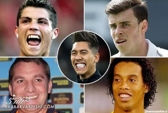 فوتبالیست‌هایی که دندان‌های‌شان را ترمیم کرده‌اند/ دندان بهتر ...