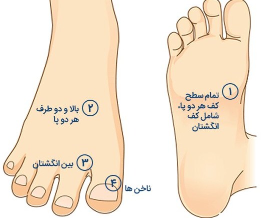 علائمی روی پاها که می‌توانند نشانه ملانوما و سرطان پوست باشند ...