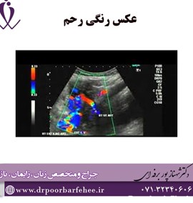 مراکز عکس رنگی رحم در شیراز