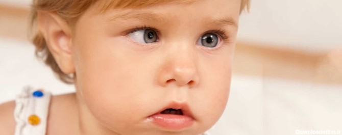 تنبلی چشم کودکان علائم مختلفی دارد
