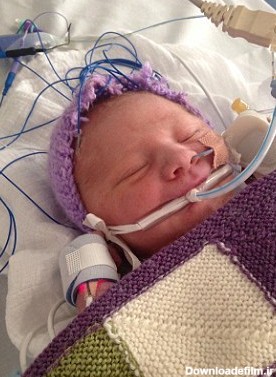نوزاد تازه بدنیا آمده پس از مرگ دوباره زنده شد+ تصاویر - تسنیم