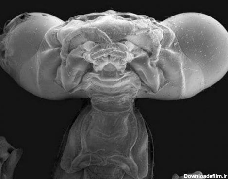 ببینید | هیولاهای میکروسکوپی زیر ناخن انسان (+عکس)