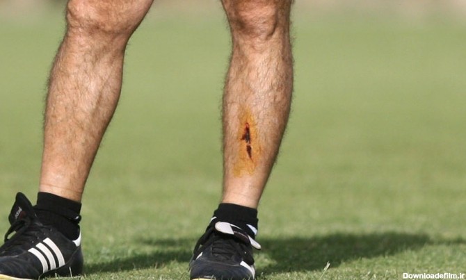راز زخم عمیق روی ساق پای ساپینتو (عکس) - ورزش سه
