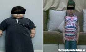 چاق ترين کودک دنيا لاغر شد+عکس