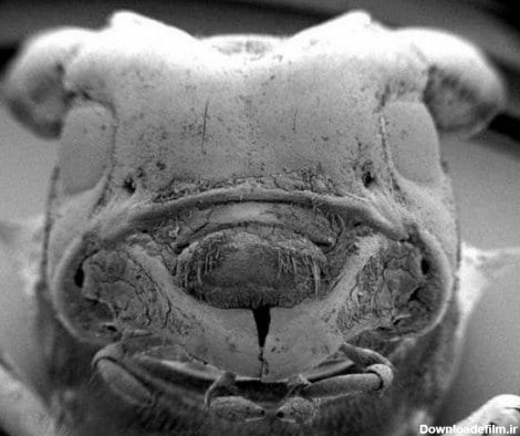 هیولاهای میکروسکوپی زیر ناخن انسان (+عکس)