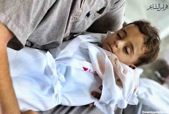 کودک غزه ای | بوسه پدر بزرگ بر پیشانی نوه اش