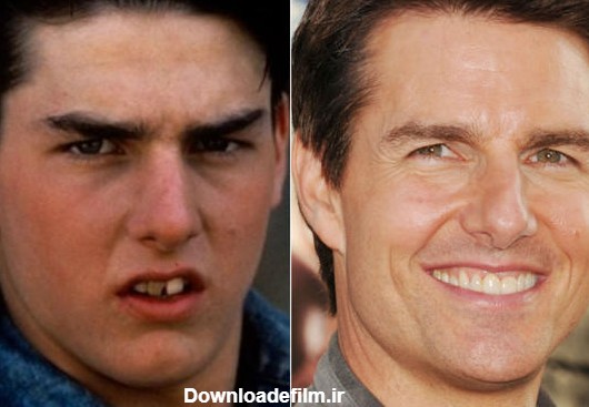 فرارو | (تصاویر) کریس رونالدو قبل و بعد از ارتودنسی!